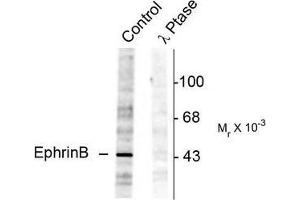 Image no. 1 for anti-Ephrin B1 (EFNB1) (pTyr298) antibody (ABIN372619) (Ephrin B1 Antikörper  (pTyr298))