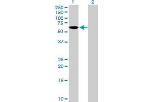 Western Blot analysis of ZNF777 expression in transfected 293T cell line by ZNF777 MaxPab polyclonal antibody. (ZNF777 Antikörper  (AA 1-518))