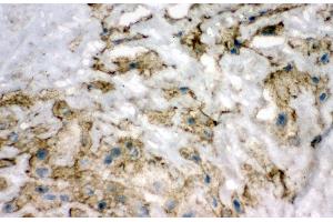 Anti-Superoxide Dismutase 3 antibody, IHC(F) IHC(F): Human Placenta Tissue