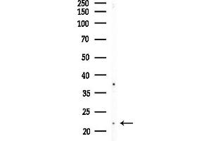 Western blot analysis of lysates from Hela cells(starvation,24h treatment), using CSRP1 Antibody at 1/1000 dilution.
