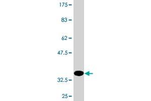 Western Blot detection against Immunogen (36. (Kallikrein 4 Antikörper  (AA 159-254))