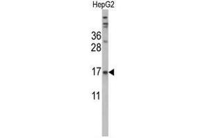 Western blot analysis of TTR Antibody (Center) in HepG2 cell line lysates (35ug/lane). (TTR Antikörper  (Middle Region))