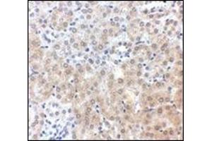 Immunohistochemistry (Paraffin-embedded Sections) (IHC (p)) image for anti-Niemann-Pick Disease, Type C1 (NPC1) (C-Term) antibody (ABIN500383)