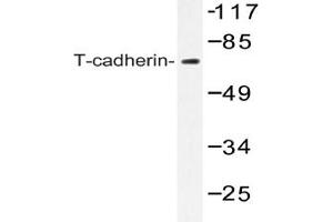 Image no. 1 for anti-Cadherin 13 (CDH13) antibody (ABIN272293) (Cadherin 13 Antikörper)