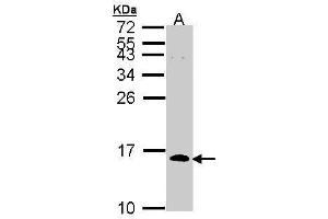 WB Image Sample (30 ug of whole cell lysate) A: H1299 15% SDS PAGE antibody diluted at 1:1000 (CDC26 Antikörper)