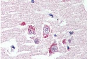 Anti-GPR98 antibody  ABIN1048902 IHC staining of human brain, cortex. (ADGRV1 / GPR98 Antikörper  (N-Term))