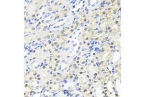 Immunohistochemistry of paraffin-embedded Mouse kidney using TRIM27 antibody (ABIN7269922) at dilution of 1:100 (40x lens). (TRIM27 Antikörper  (AA 1-200))