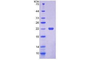 SDS-PAGE analysis of Human DKC Protein. (DKC1 Protein)
