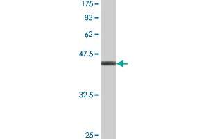 Western Blot detection against Immunogen (37. (Retinoic Acid Receptor alpha Antikörper  (AA 315-424))