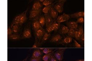 Immunofluorescence analysis of C6 cells using ACBD3 Polyclonal Antibody at dilution of 1:100. (ACBD3 Antikörper)
