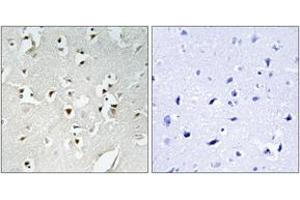 Immunohistochemistry analysis of paraffin-embedded human brain, using PMS1 Antibody.