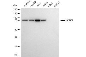 Western blotting analysis using IKBKB antibody (ABIN7799033).