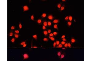 Immunofluorescence analysis of HeLa cells using BACH1 Polyclonal Antibody at dilution of 1:100. (BACH1 Antikörper)