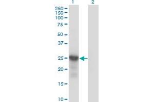 Western Blotting (WB) image for anti-Cyclin-Dependent Kinase Inhibitor 1B (p27, Kip1) (CDKN1B) (AA 1-198) antibody (ABIN4888951)