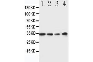 Anti-MyD88 antibody, Western blotting Lane 1: Rat Spleen Tissue Lysate Lane 2: Rat Thymus Tissue Lysate Lane 3: JURKAT Cell Lysate Lane 4: RAJI Cell Lysate (MYD88 Antikörper  (Middle Region))