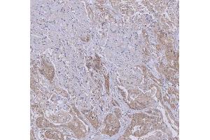 IHC analysis of WDR44 using anti-WDR44 antibody (ABIN7600394). (WDR44 Antikörper  (AA 188-913))