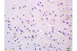 Formalin-fixed and paraffin embedded rat brain labeled with Anti-ADCY8 Polyclonal Antibody, Unconjugated (ABIN751228) at 1:200 followed by conjugation to the secondary antibody and DAB staining. (ADCY8 Antikörper  (AA 151-250))