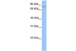WB Suggested Anti-ZNF555 Antibody Titration:  0. (ZNF555 Antikörper  (N-Term))