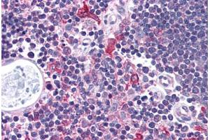 Human Thymus (formalin-fixed, paraffin-embedded) stained with CHEK1 antibody ABIN214737 at 5 ug/ml followed by biotinylated goat anti-rabbit IgG secondary antibody ABIN481713, alkaline phosphatase-streptavidin and chromogen. (CHEK1 Antikörper  (AA 192-241))
