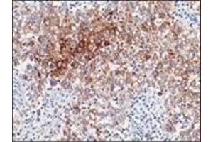 Immunohistochemistry (IHC) image for anti-Placental Alkaline Phosphatase (ALPP) antibody (ABIN870410) (PLAP Antikörper)