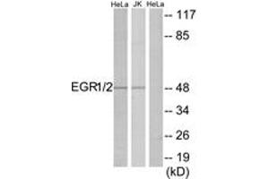 Western blot analysis of extracts from HeLa/Jurkat cells, using EGR1/2 Antibody. (EGR1 + EGR2 (AA 371-420) Antikörper)