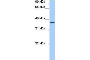ALKBH8 antibody used at 0. (ALKBH8 Antikörper)