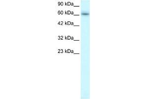 Western Blotting (WB) image for anti-TRAF-Type Zinc Finger Domain Containing 1 (TRAFD1) (C-Term) antibody (ABIN2777613)