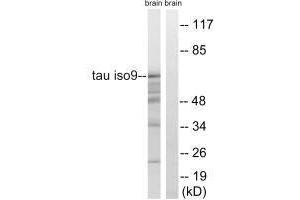 Western blot analysis of extracts from rat brain cells, using Tau (Ab-717/400) antibody. (MAPT Antikörper  (Ser400, Ser717))