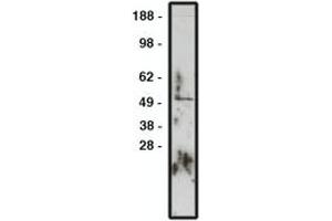 Image no. 1 for anti-Zinc Finger Protein GLI1 (GLI1) antibody (ABIN793725) (GLI1 Antikörper)