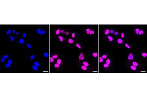 Immunocytochemical staining of HT- cells with Phospho-AKT1 (T450) antibody (ABIN7800786), 1:1,000). (Rekombinanter AKT1 Antikörper  (pThr450))