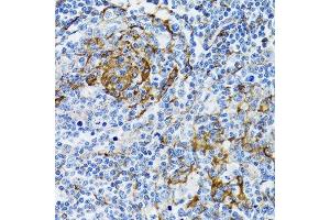 Immunohistochemistry (Paraffin-embedded Sections) (IHC (p)) image for anti-Progesterone Receptor Membrane Component 1 (PGRMC1) (AA 44-195) antibody (ABIN6145520)