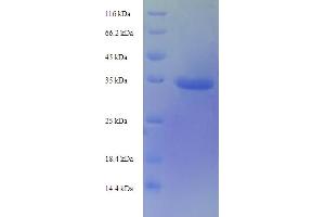 SDS-PAGE (SDS) image for TIMP Metallopeptidase Inhibitor 1 (TIMP1) (AA 25-205) protein (His-SUMO Tag) (ABIN5710496)
