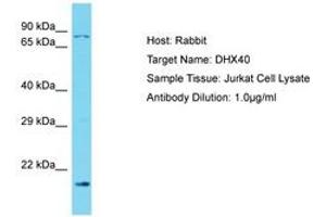 Image no. 1 for anti-DEAH (Asp-Glu-Ala-His) Box Polypeptide 40 (DHX40) (N-Term) antibody (ABIN6750559) (DEAH (Asp-Glu-Ala-His) Box Polypeptide 40 (DHX40) (N-Term) Antikörper)
