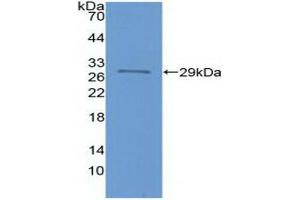 Detection of Recombinant FOXP3, Human using Polyclonal Antibody to Forkhead Box P3 (FOXP3) (FOXP3 Antikörper  (AA 191-412))