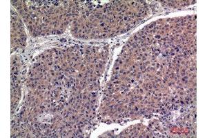 Immunohistochemistry (IHC) analysis of paraffin-embedded Human Lung, antibody was diluted at 1:100. (IGFBPI Antikörper  (Internal Region))