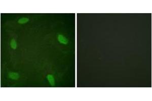 Immunofluorescence analysis of HeLa cells treated with Forskolin 40nM 30', using SSB (Phospho-Ser366) Antibody. (SSB Antikörper  (pSer366))
