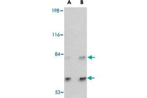 Western blot analysis of SATB2 in A-20 cell lysate with SATB2 polyclonal antibody  at (A) 2 and (B) 4 ug/mL . (SATB2 Antikörper  (C-Term))