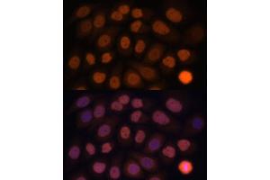 Immunofluorescence analysis of HeLa cells using KLF6 antibody (ABIN6131578, ABIN6142923, ABIN6142924 and ABIN6214111) at dilution of 1:100. (KLF6 Antikörper  (AA 40-200))
