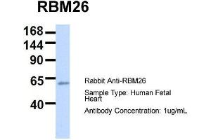 Host:  Rabbit  Target Name:  RBM26  Sample Type:  Human Fetal Heart  Antibody Dilution:  1. (RBM26 Antikörper  (Middle Region))