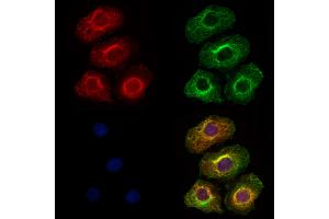 ABIN6264963 and ABIN6273315 staining Hela cells by IF/ICC. (SEC63 Antikörper  (C-Term))