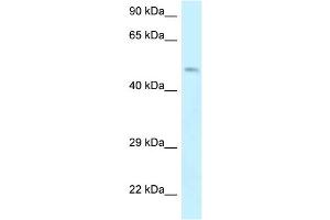 WB Suggested Anti-EPB49 Antibody Titration: 1.
