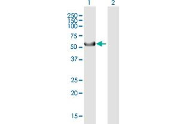 Keratin 39 (KRT39) (AA 1-491) Antikörper