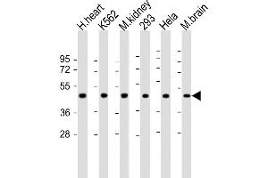 All lanes : Anti-hGDF11-R47 at 1:2000 dilution Lane 1: human heart lysate Lane 2: K562 whole cell lysate Lane 3: mouse kidney lysate Lane 4: 293 whole cell lysate Lane 5: Hela whole cell lysate Lane 5: mouse brain lysate Lysates/proteins at 20 μg per lane. (GDF11 Antikörper  (N-Term))