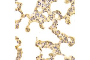 Immunohistochemistry of paraffin-embedded rat lung using FABP4 antibody at dilution of 1:100 (x400 lens). (FABP4 Antikörper)
