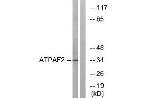 Western blot analysis of extracts from Jurkat cells, using ATPAF2 antibody. (ATPAF2 Antikörper)