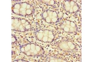 Immunohistochemistry (IHC) image for anti-Taste Receptor, Type 2, Member 13 (TAS2R13) (AA 150-184) antibody (ABIN7171536)