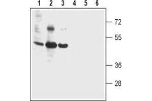 Western blot analysis of human colon cancer cell lines Colo-205 (lanes 1 and 4), human T-84 colonic adenocarcinoma cell line (lanes 2 and 5) and human colon cancer HT-29 cell line (lanes 3 and 6): - 1-3. (Bestrophin 2 Antikörper  (3rd Extracellular Loop))