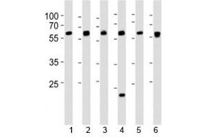 Western blot analysis of lysate from 1) 293, 2) HepG2, 3) HUVEC, 4) Raji, 5) rat C6 and 6) mouse C2C12 cell line using SPHK1 antibody at 1:1000. (SPHK1 Antikörper  (AA 286-315))