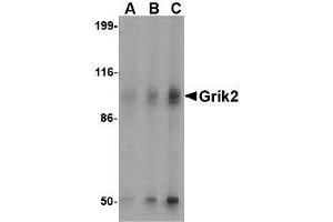 Western blot analysis of Grik2 in human brain tissue lysate with AP30382PU-N Grik2 antibody at (A) 0. (GRIK2 Antikörper  (C-Term))