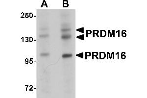 Western Blotting (WB) image for anti-PR Domain Containing 16 (PRDM16) (C-Term) antibody (ABIN1030598)